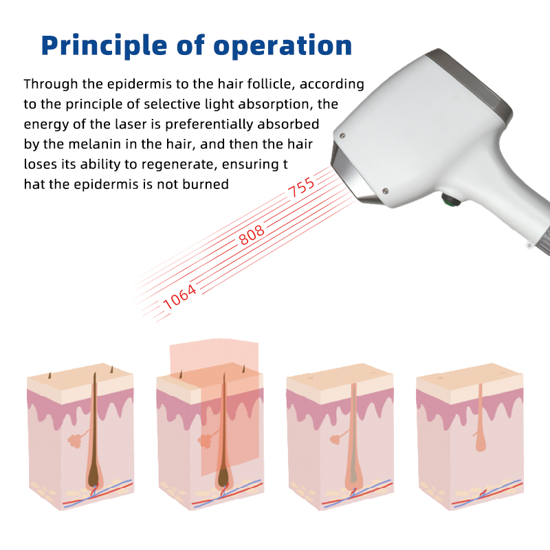 Diode + Pico Laser Machine Hair Removal & Tattoo Removal System