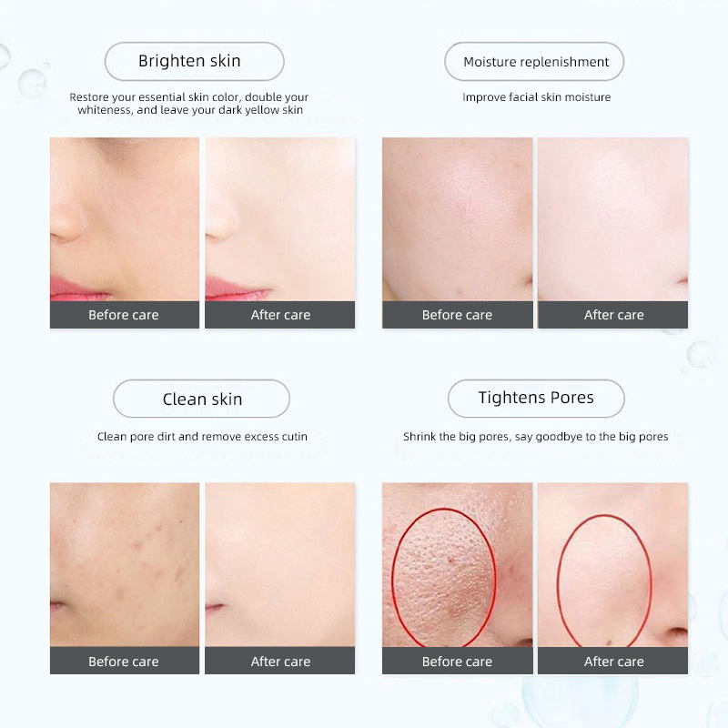 S-Shape Body Contouring Machine RF Cavitation Vacuum Slimming Device