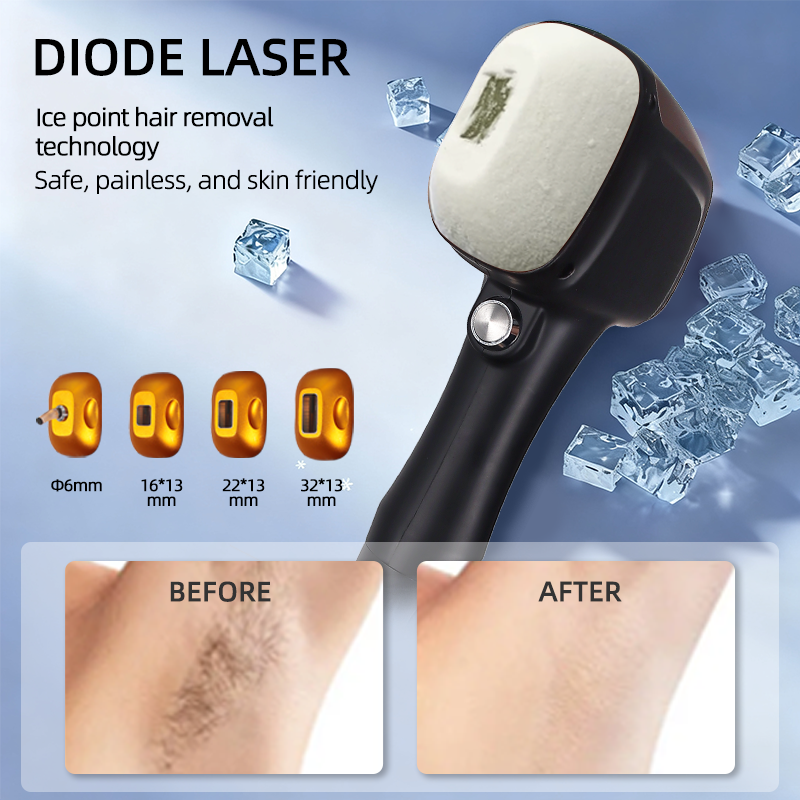 4 Wavelength Diode Laser Hair Removal Machine with Magnetic Heads 755/808/940/1064nm