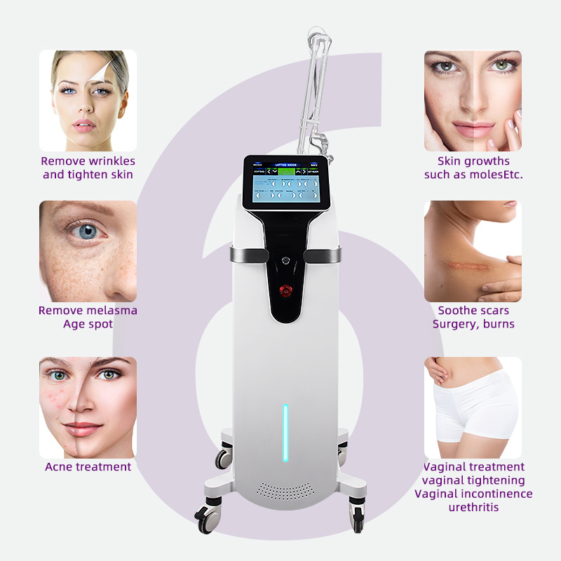 CO2 Laser Machine