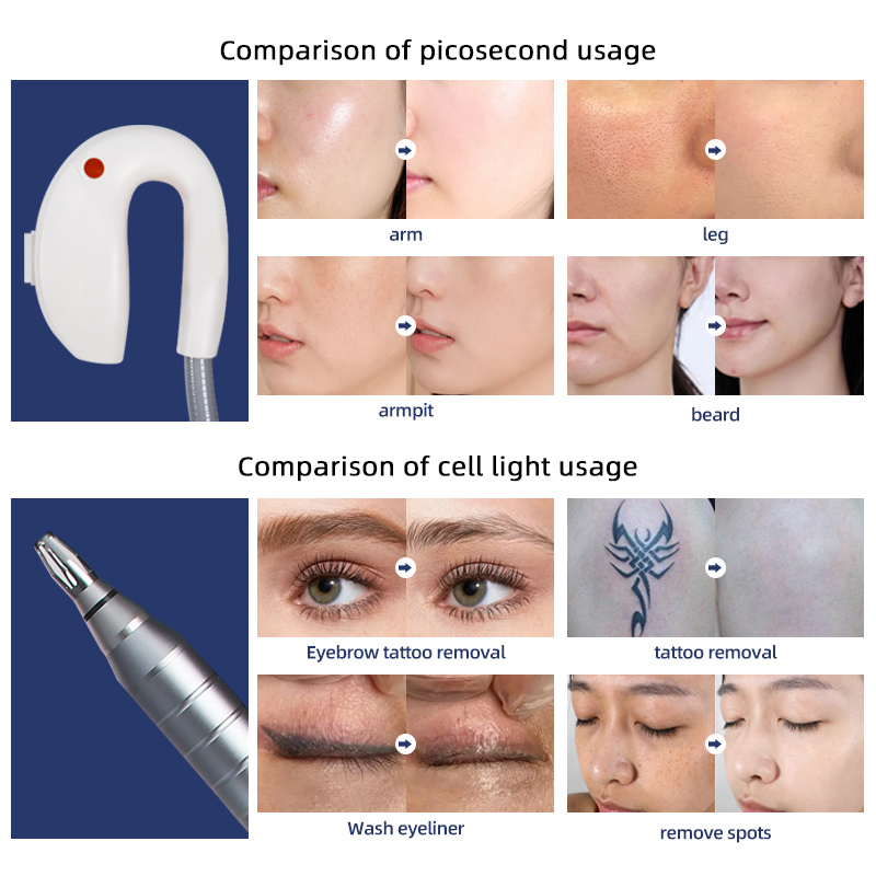 Picosecond Laser Machine Vertical 2-in-1 Tattoo Removal Skin Rejuvenation Equipment