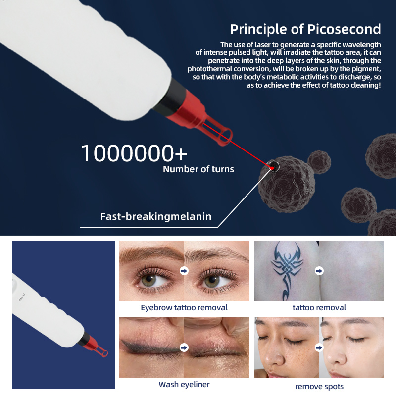 Portable Picosecond Laser Machine 532/1064/1320nm Tattoo Removal Beauty Equipment