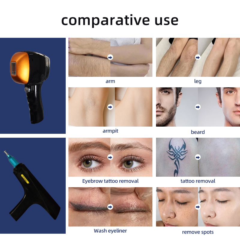 Vertical 2-in-1 Diode Laser Hair Removal and YAG Tattoo Removal Machine