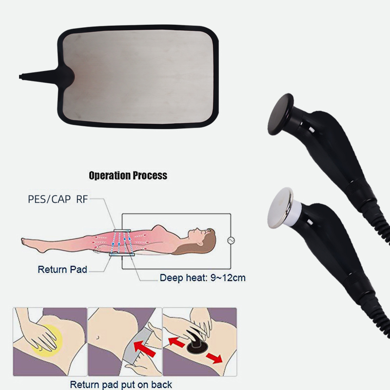 448k RF Fever Master Body Sculpting Machine Skin Tightening Therapy Device