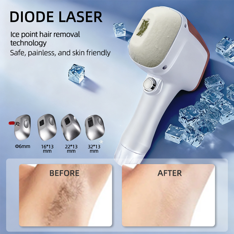 4 Wavelength Diode Laser Hair Removal Machine with Magnetic Therapy Heads 755/808/940/1064nm