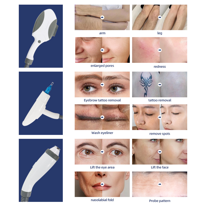 3 in 1 Photon Skin Rejuvenation IPL Laser Beauty Machine Multifunction Device