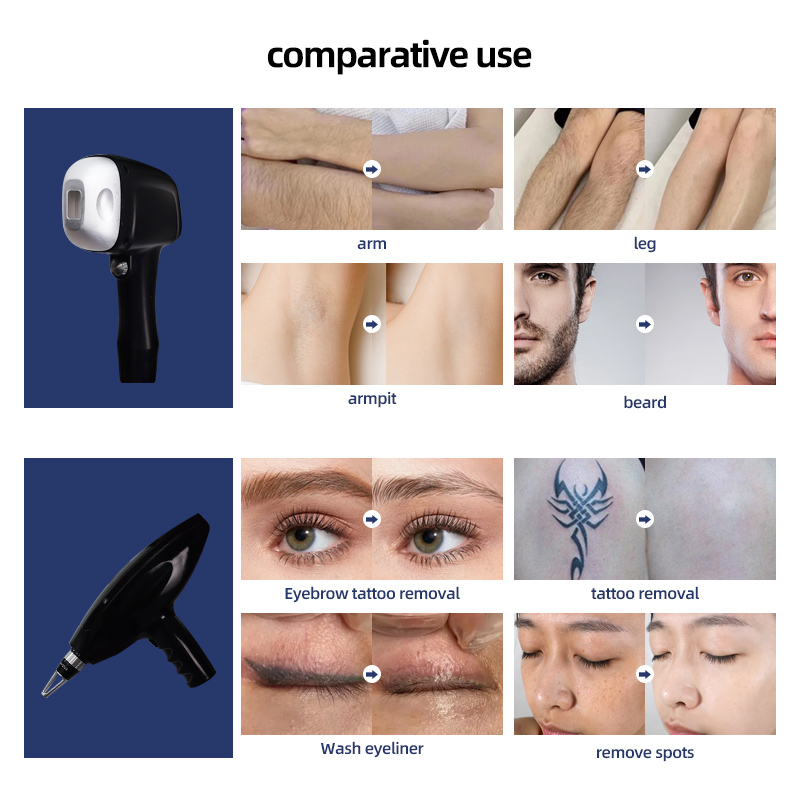 2 in 1 Diode Laser Hair Removal and YAG Laser Tattoo Removal Machine Professional Beauty Device