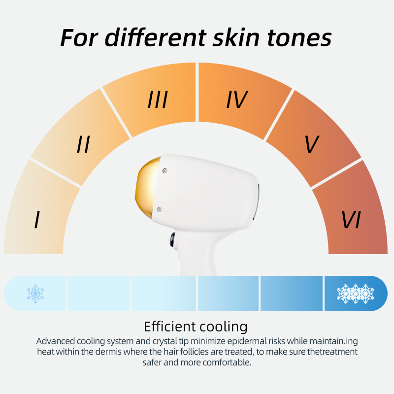 755 808 1064nm Diode Laser Hair Removal Machine 3 Wavelength Professional Beauty Device