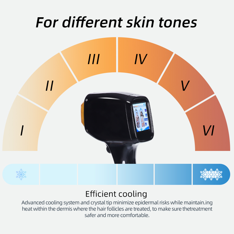 808nm Diode Laser Hair Removal Machine Powerful Cooling System Professional Device