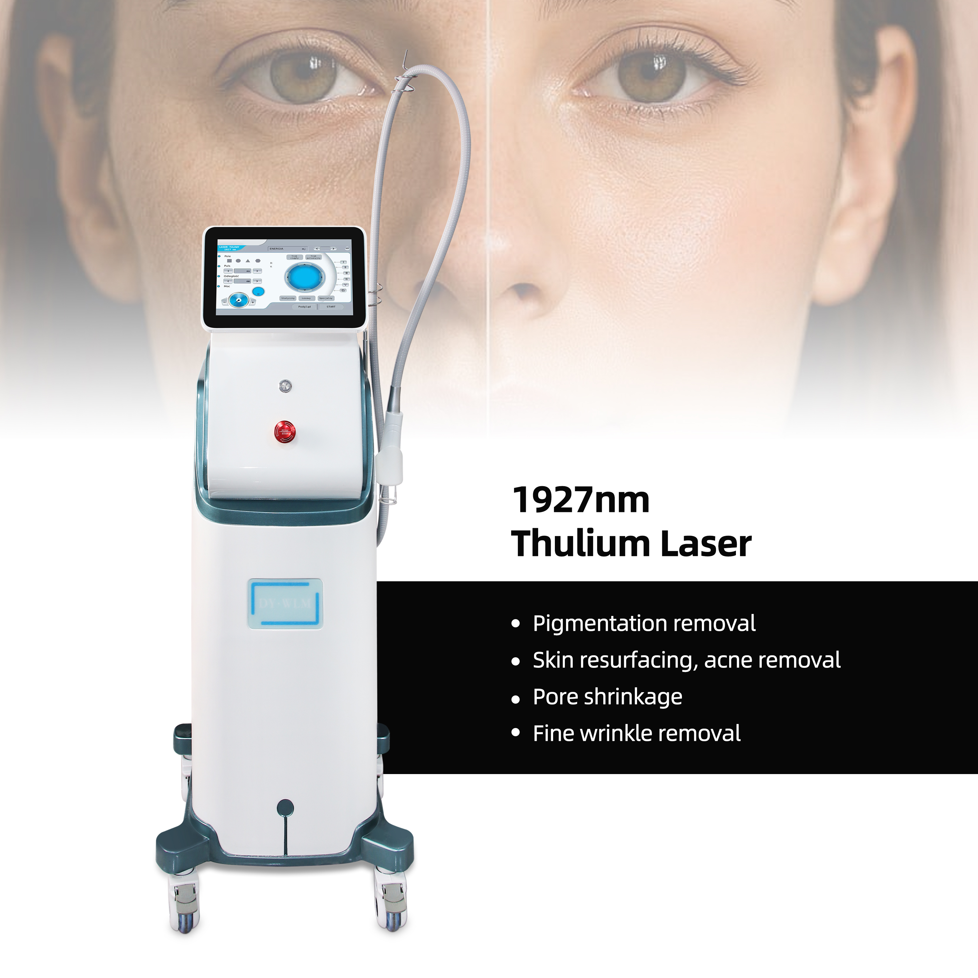 2026 1927nm Thulium Laser Machine Non-Ablative Skin Rejuvenation Fractional Laser Device