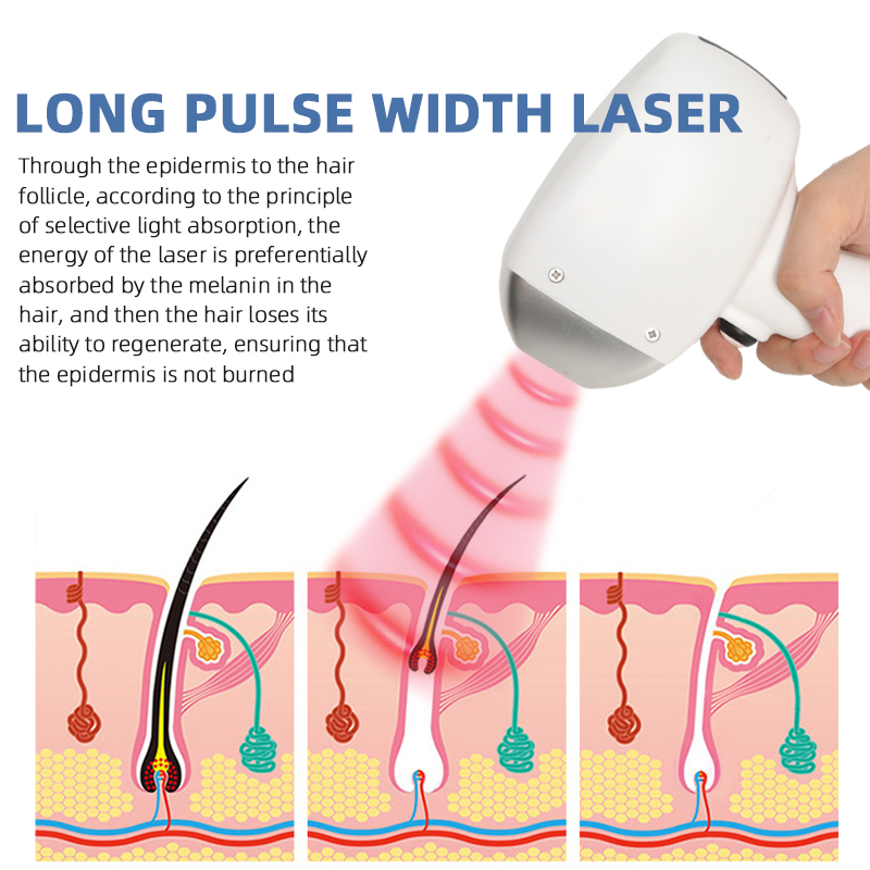 808nm Diode Laser Hair Removal Machine Desktop Professional Beauty Device