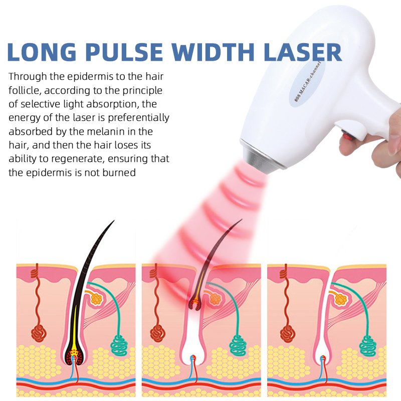 Portable 808nm Diode Laser Hair Removal Machine 755/808/1064nm Beauty Device