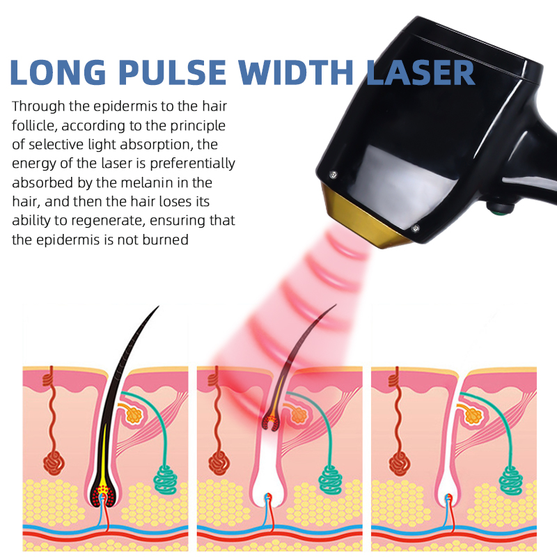 808nm Diode Laser Hair Removal Machine Powerful Cooling System Professional Device