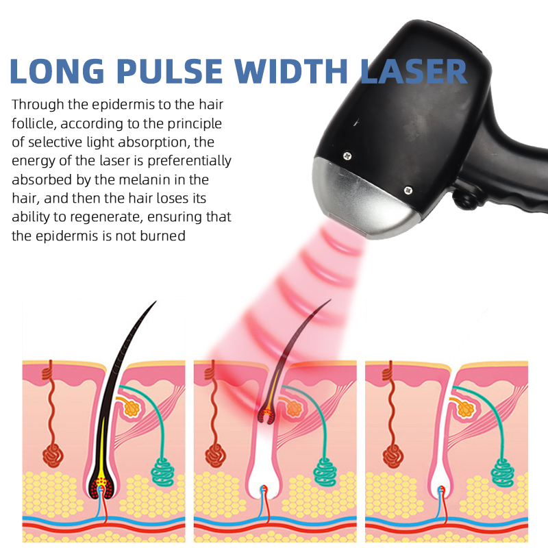 755 808 1064nm Diode Laser Hair Removal Machine Three Wavelength Desktop Beauty Device