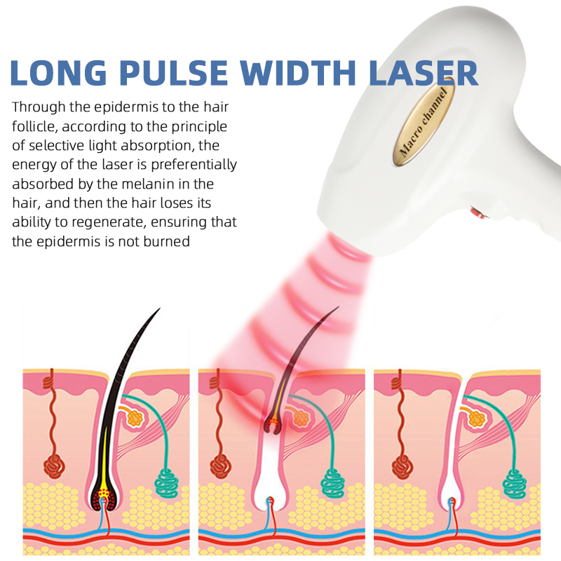 808nm Diode Laser Hair Removal Machine Ice Cooling Beauty Device Professional
