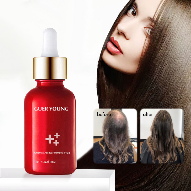 Herbal Hair Growth Serum – Anti Hair Loss & Scalp Repair Treatment