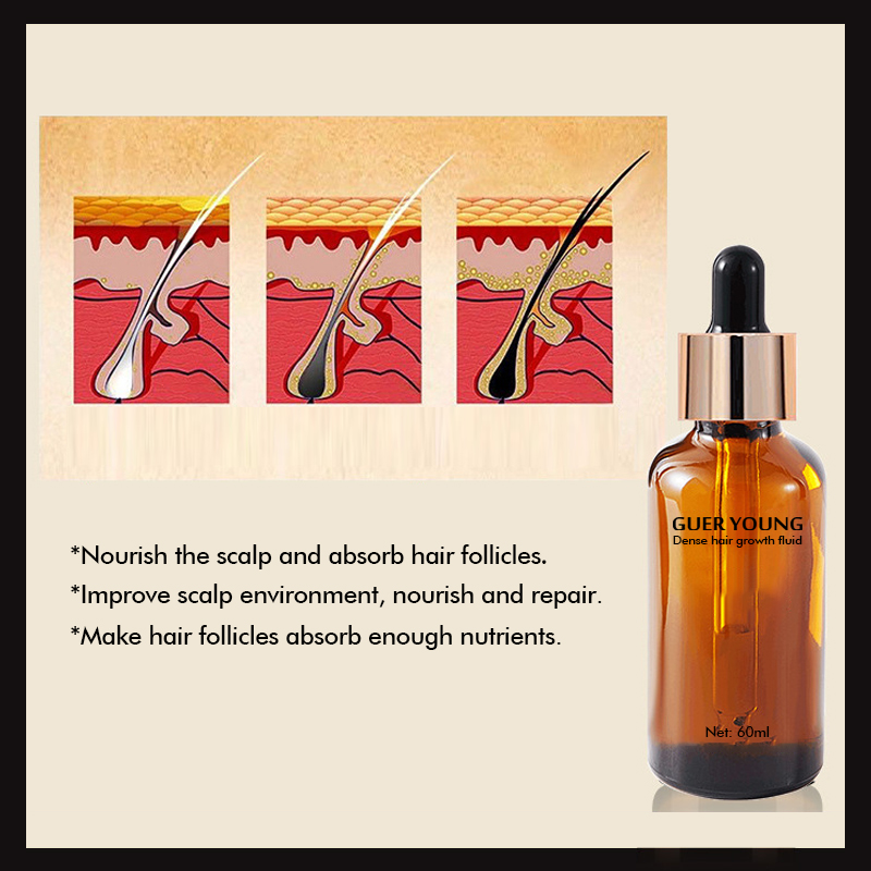 Herbal Hair Regrowth Essence – 60ml Natural Treatment for Thinning Hair & Scalp Nourishment