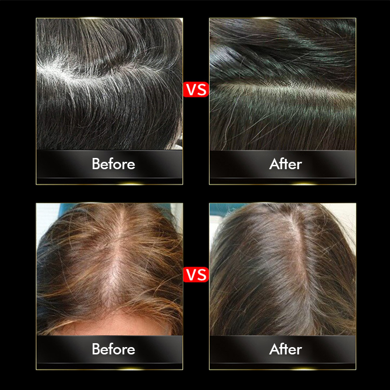 Plant Extract Hair Growth Care Fluid - 100ml Herbal Hair Regrowth Serum