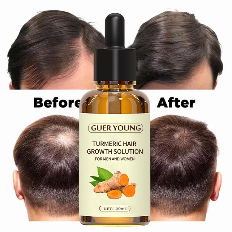 Turmeric Hair Growth Solution with Natural Plant Extracts for Men and Women